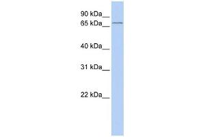 WB Suggested Anti-ALOX15B Antibody Titration:  0.