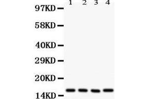 Western Blotting (WB) image for anti-Caveolin 2 (CAV2) (AA 1-162) antibody (ABIN3043749)