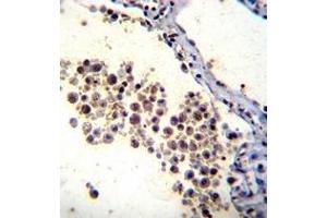 Formalin fixed and paraffin embedded human lung tissue reacted with DOK3 Antibody (C-term) followed by peroxidase conjugation of the secondary antibody and DAB staining. (DOK3 antibody  (C-Term))