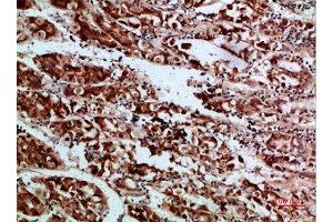 Immunohistochemistry (IHC) image for anti-REL proto-oncogene (c-Rel) (AA 491-540) antibody (ABIN7189505)