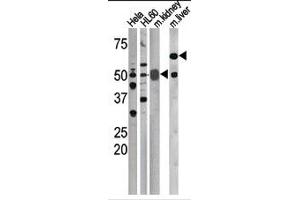 Image no. 1 for anti-Cell Division Cycle 25 Homolog A (S. Pombe) (CDC25A) (pSer76) antibody (ABIN358097) (CDC25A antibody  (pSer76))