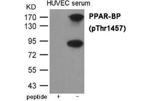 Western blot analysis of extracts from HUVEC cells treated with serum using PPAR-BP (Phospho-Thr1457) Antibody.