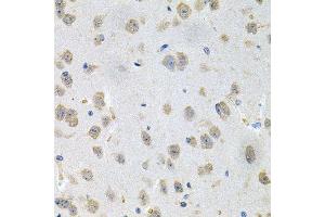 Immunohistochemistry (Paraffin-embedded Sections) (IHC (p)) image for anti-Glucosamine (UDP-N-Acetyl)-2-Epimerase/N-Acetylmannosamine Kinase (GNE) (AA 1-150) antibody (ABIN6141232)