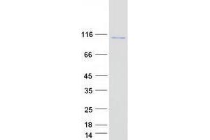 XRN2 Protein (Myc-DYKDDDDK Tag)