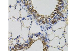 Immunohistochemistry of paraffin-embedded Mouse lung using CKAP4 Polyclonal Antibody (CKAP4 antibody)