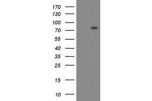 Western Blotting (WB) image for anti-Oxysterol Binding Protein-Like 11 (OSBPL11) antibody (ABIN1499920) (OSBPL11 antibody)