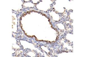 Immunohistochemistry of paraffin embedded rat testis using MLF1 (ABIN7074712) at dilution of 1: 1500 (400x lens) (MLF1 antibody)