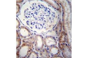 Immunohistochemistry analysis in formalin fixed and paraffin embedded human kidney tissue reacted with STARD5 Antibody (N-term) followed which was peroxidase conjugated to the secondary antibody and followed by AB staining. (STARD5 antibody  (N-Term))