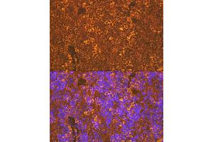 Immunofluorescence analysis of rat spleen using CXCR5 Rabbit mAb (ABIN7266321) at dilution of 1:100 (40x lens). (CXCR5 antibody)