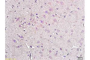 Formalin-fixed and paraffin embedded rat brain tissue labeled with Anti-NPY2R Polyclonal Antibody, Unconjugated (ABIN730063) at 1:200, followed by conjugation to the secondary antibody and DAB staining (NPY2R antibody  (AA 301-381))