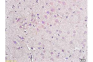 Formalin-fixed and paraffin embedded rat brain tissue labeled with Anti-NPY2R Polyclonal Antibody, Unconjugated (ABIN730063) at 1:200, followed by conjugation to the secondary antibody and DAB staining