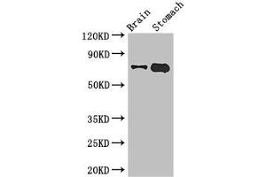Western Blot Positive WB detected in: Mouse brain tissue, Mouse stomach tissue All lanes: EXD2 antibody at 2. (EXD2 antibody  (AA 137-245))