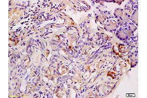 Formalin-fixed and paraffin embedded rat pancreas labeled with Anti-Adiponectin Receptor 2 Polyclonal Antibody, Unconjugated (ABIN670851) at 1:200, followed by conjugation to the secondary antibody and DAB staining (Adiponectin Receptor 2 antibody  (AA 315-340))