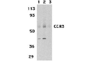 Western blot analysis of CCR3 in human spleen tissue lysates with AP30216PU-N CCR3 antibody at 1 (lane 1) and 2 μg/ml (lane 2), and 2 μg/ml in the presence of blocking peptide (lane 3). (CCR3 antibody  (N-Term))