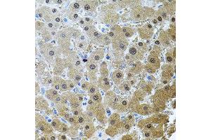 Immunohistochemistry of paraffin-embedded human liver injury using RNF166 antibody. (RNF166 antibody)