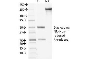 SDS-PAGE Analysis Purified Desmocollin-2/3 Mouse Monoclonal Antibody (7G6).