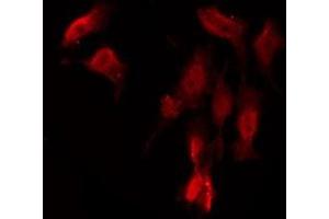 ABIN6276026 staining Hela by IF/ICC. (GPRC6A antibody  (Internal Region))