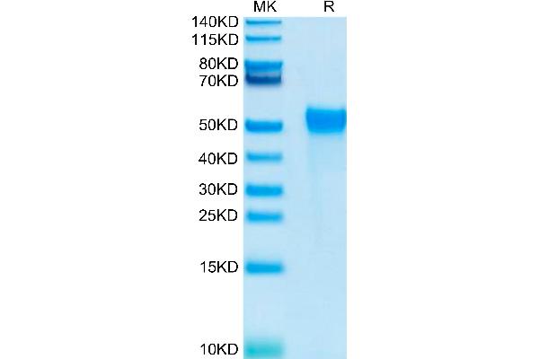 KIR2DL2 Protein (His-Avi Tag,Biotin)
