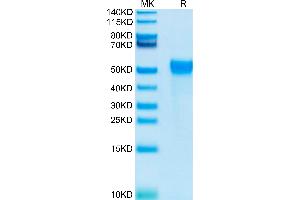 Biotinylated Human KIR2DL2 on Tris-Bis PAGE under reduced conditions. (KIR2DL2 Protein (His-Avi Tag,Biotin))