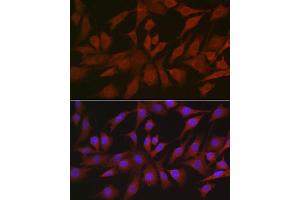 Immunofluorescence analysis of NIH/3T3 cells using EIF4ENIF1 Rabbit pAb (ABIN7267051) at dilution of 1:100 (40x lens). (EIF4ENIF1 antibody  (AA 150-250))