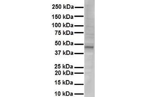 WB Suggested Anti-NR1I2 antibody Titration: 1 ug/mL Sample Type: Human liver (NR1I2 antibody  (N-Term))