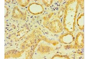 Immunohistochemistry of paraffin-embedded human kidney tissue using ABIN7158861 at dilution of 1:100 (DCP2 antibody  (AA 1-240))