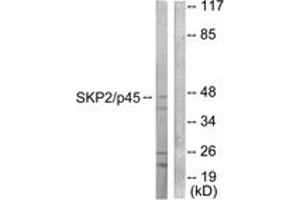 Western blot analysis of extracts from 293 cells, using SKP2/p45 Antibody. (SKP2 antibody  (AA 366-415))