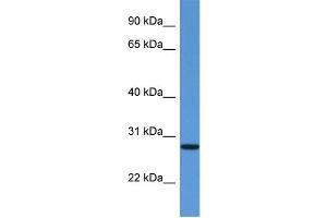 WB Suggested Anti-EDN3 Antibody Titration: 1. (Endothelin 3 antibody  (C-Term))