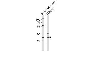 Western blot analysis of lysates from human skeletal muscle, mouse testis tissue lysate (from left to right), using Mlf1 Antibody (Center) (ABIN6242439 and ABIN6577655). (MLF1 antibody  (AA 91-126))