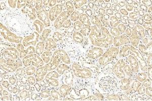 Immunohistochemical analysis of paraffin-embedded Human kidney section using Pink1 A. (BAP1 antibody  (AA 36-66))