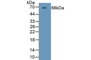 Detection of Recombinant Kim1, Human using Polyclonal Antibody to Kidney Injury Molecule 1 (Kim1) (HAVCR1 antibody  (AA 21-293))