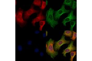 ABIN6264702 and ABIN6269113 staining Hela cells by IF/ICC. (Ret Proto-Oncogene antibody  (C-Term))