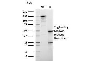 SDS-PAGE Analysis Purified HER-2 Mouse Monoclonal Antibody (ERBB2/3078). (ErbB2/Her2 antibody  (AA 311-462))