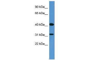 WB Suggested Anti-OR2W1 Antibody Titration: 0. (OR2W1 antibody  (C-Term))