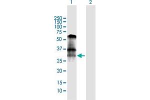 Western Blot analysis of BNIP3 expression in transfected 293T cell line by BNIP3 MaxPab polyclonal antibody. (BNIP3 antibody  (AA 1-194))