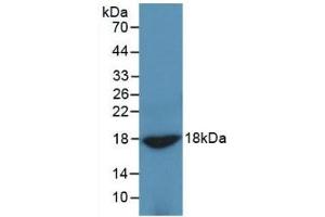 Detection of Recombinant ADP, Rat using Monoclonal Antibody to Adiponectin (ADPN) (ADIPOQ antibody  (AA 111-244))