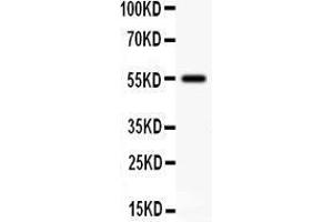 Anti- SSTR2 antibody, Western blotting All lanes: Anti SSTR2  at 0.
