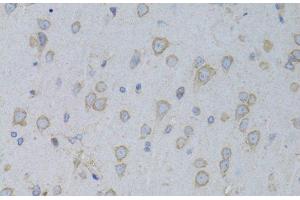 Immunohistochemistry of paraffin-embedded Rat brain using GARS Polyclonal Antibody at dilution of 1:100 (40x lens). (GARS antibody)