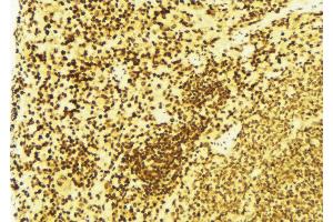 ABIN6269395 at 1/100 staining Mouse spleen tissue by IHC-P. (FANCD2 antibody  (N-Term))