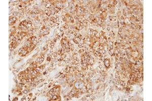 IHC-P Image Immunohistochemical analysis of paraffin-embedded SW480 xenograft, using HMGCL, antibody at 1:500 dilution.