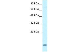 WB Suggested Anti-UBE2N  Antibody Titration: 1. (UBE2N antibody  (Middle Region))
