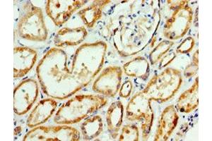 Immunohistochemistry of paraffin-embedded human kidney tissue using ABIN7144352 at dilution of 1:100 (AP1m2 antibody  (AA 164-423))