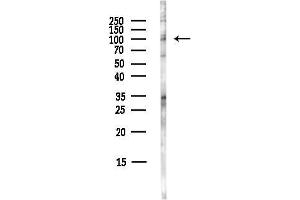anti-Proprotein Convertase Subtilisin/kexin Type 6 (PCSK6) antibody