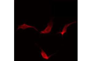 ABIN6274142 staining HuvEc by IF/ICC. (MAP4K4 antibody  (Internal Region))