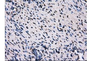 Immunohistochemical staining of paraffin-embedded liver tissue using anti-RPA2 mouse monoclonal antibody. (RPA2 antibody)