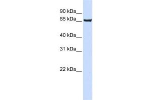 Western Blotting (WB) image for anti-SRY (Sex Determining Region Y)-Box 13 (SOX13) antibody (ABIN2460022)