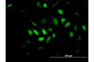 Immunofluorescence of monoclonal antibody to TFDP3 on HeLa cell. (TFDP3 antibody  (AA 1-100))