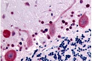 Human Brain, Cerebellum (formalin-fixed, paraffin-embedded) stained with GPR32 antibody ABIN213358 at 10 ug/ml followed by biotinylated goat anti-rabbit IgG secondary antibody ABIN481713, alkaline phosphatase-streptavidin and chromogen. (GPR32 antibody  (Cytoplasmic Domain))