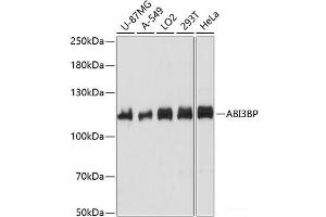 Western blot analysis of extracts of various cell lines using ABI3BP Polyclonal Antibody at dilution of 1:1000. (ABI3BP antibody)