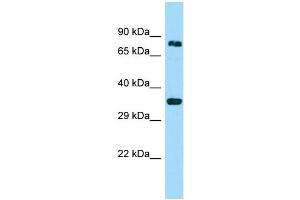 WB Suggested Anti-HOOK3 Antibody Titration: 1.